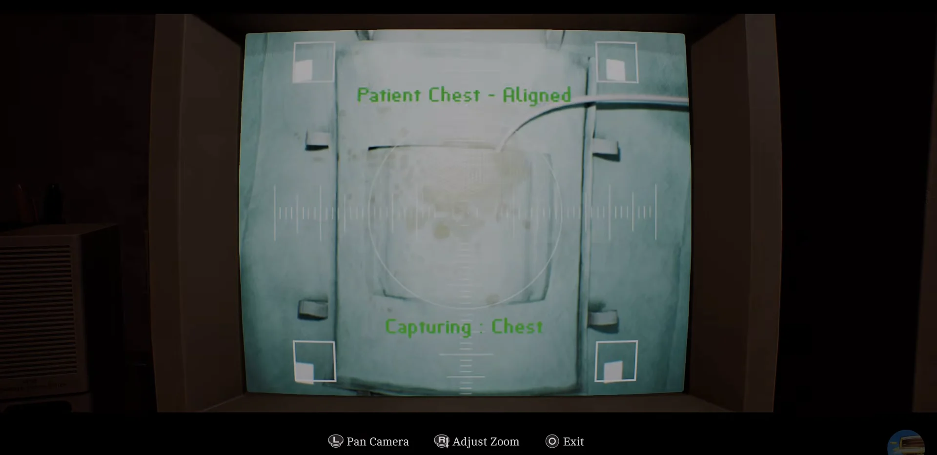 Aligning Chest Capture