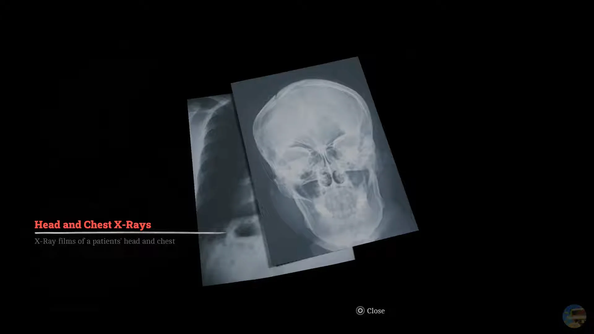 Collecting X-ray films