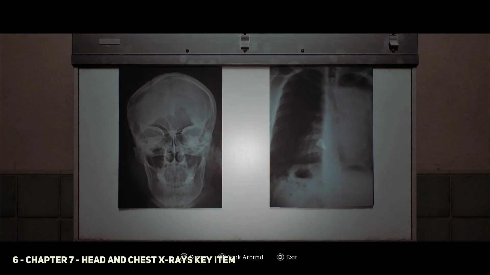 Head and Chest X-Rays Key Item