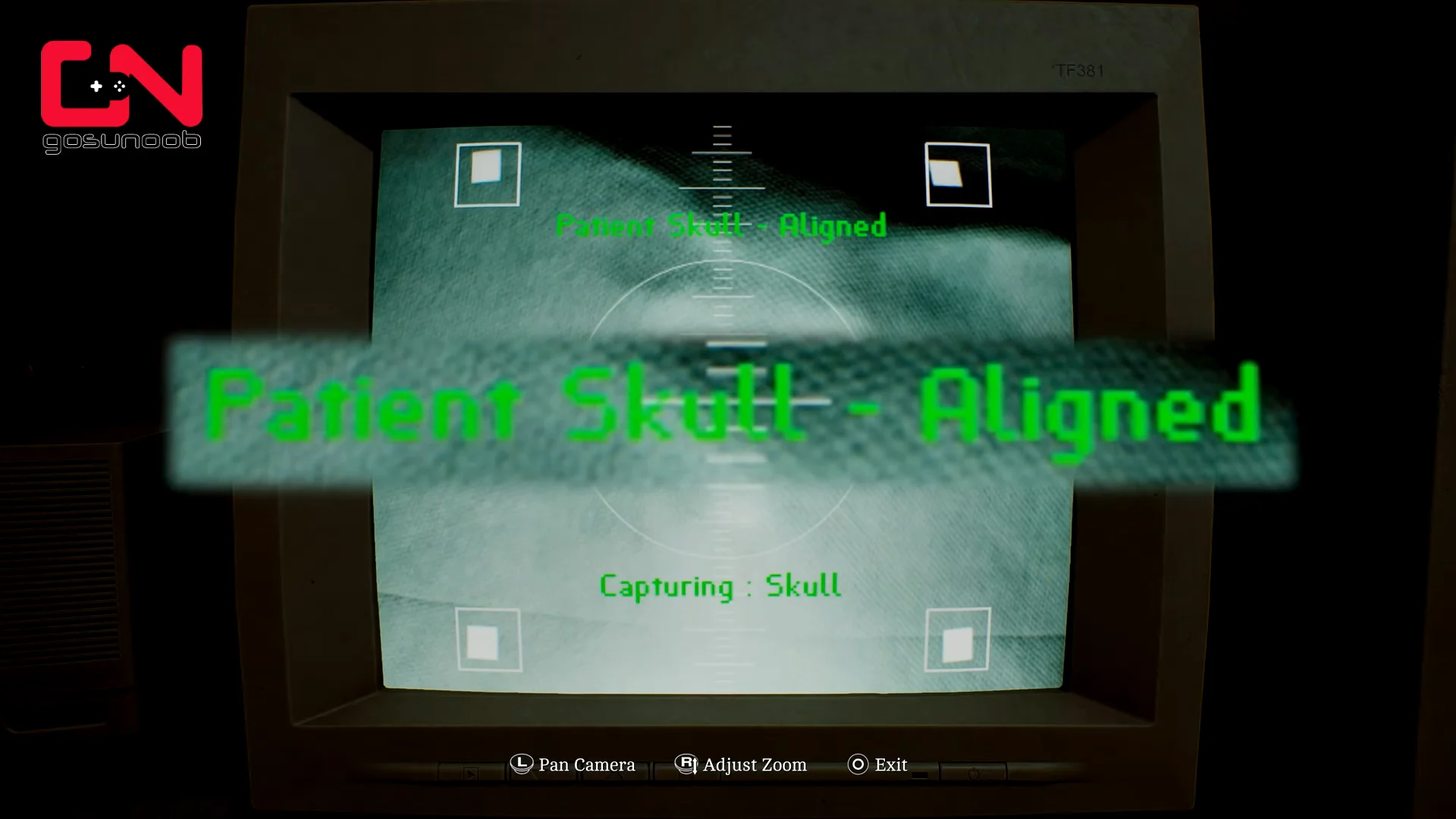 Aligning the Skull