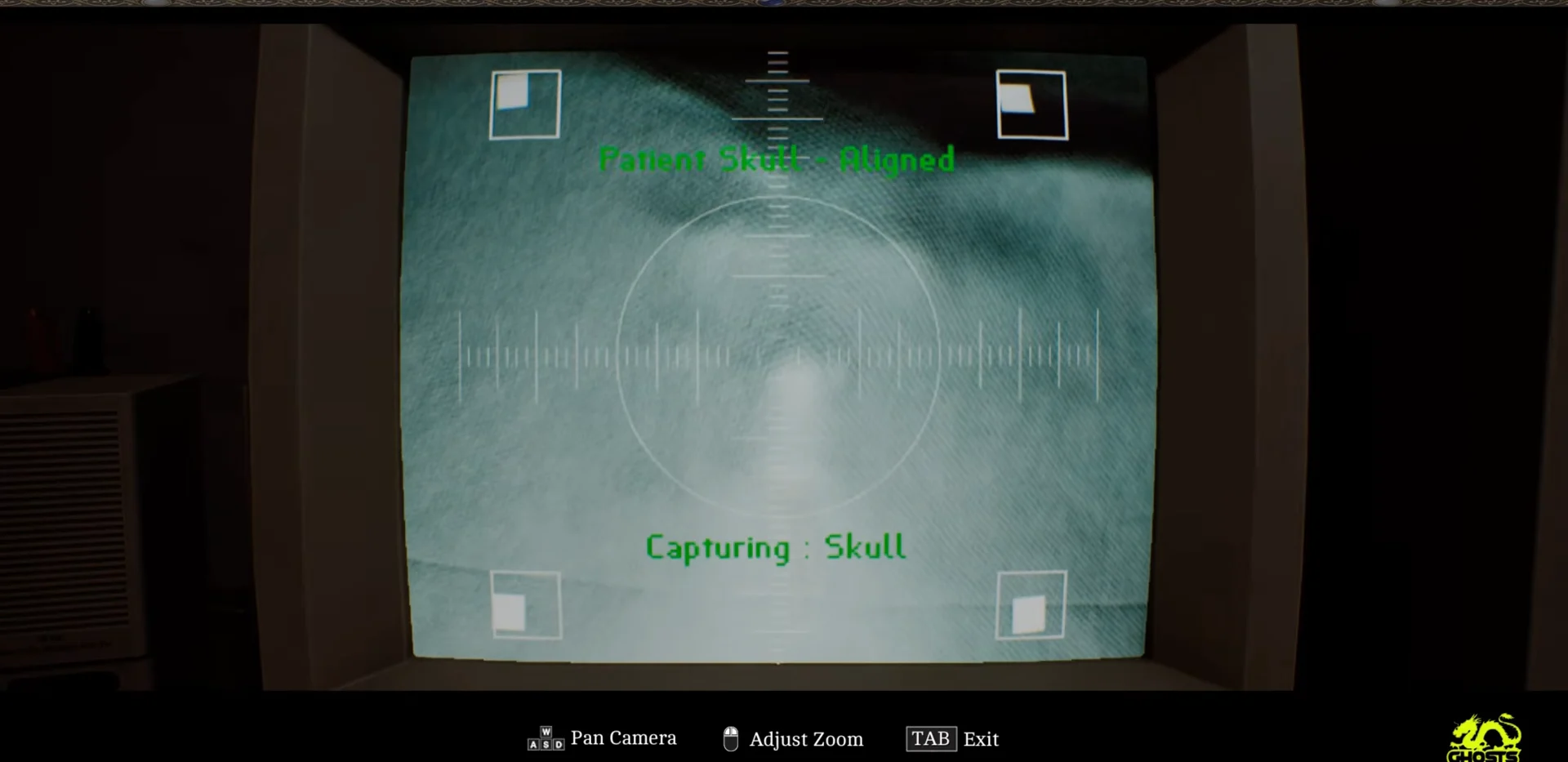 Skull Camera Alignment