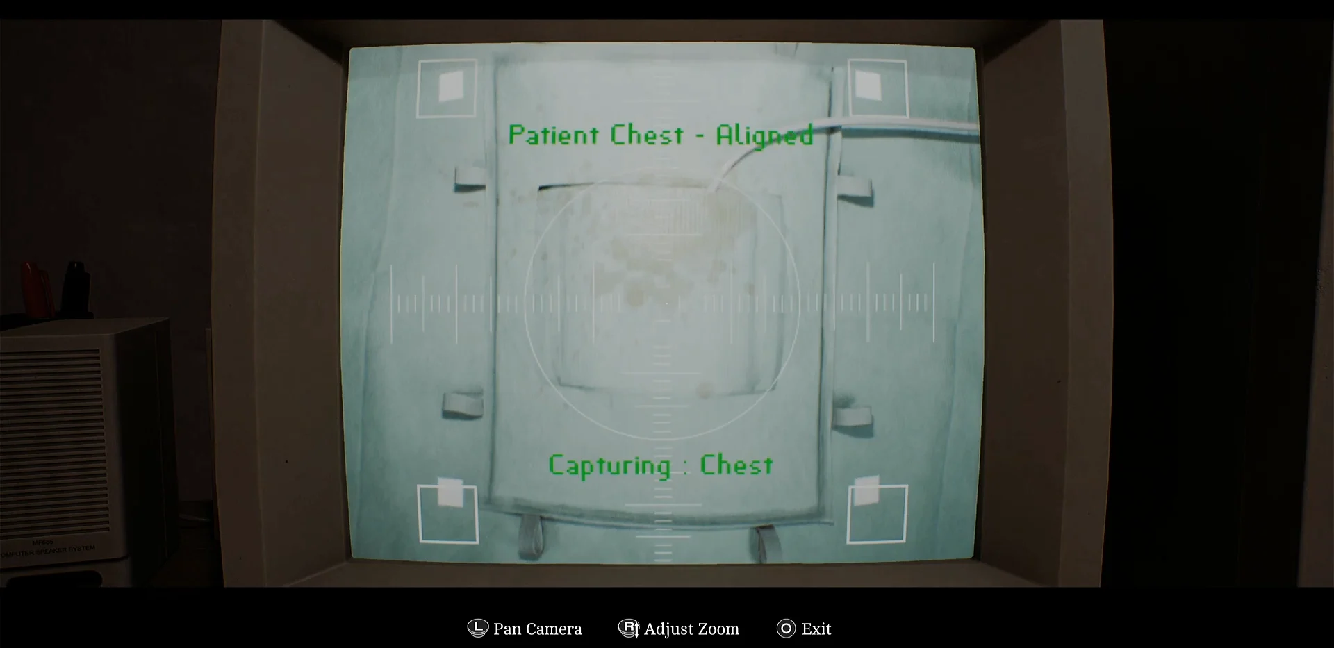 Aligning the chest camera